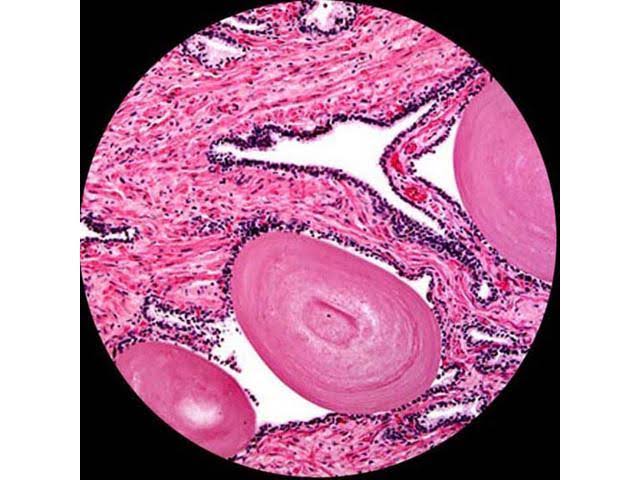 2000X LED Trinocular Compound Microscope with 3D Mechanical Stage and 5MP Camera O750133